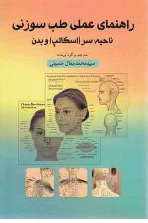 راهنمای عملی طب سوزنی (ناحیه سر(اسکالپ)و بدن)